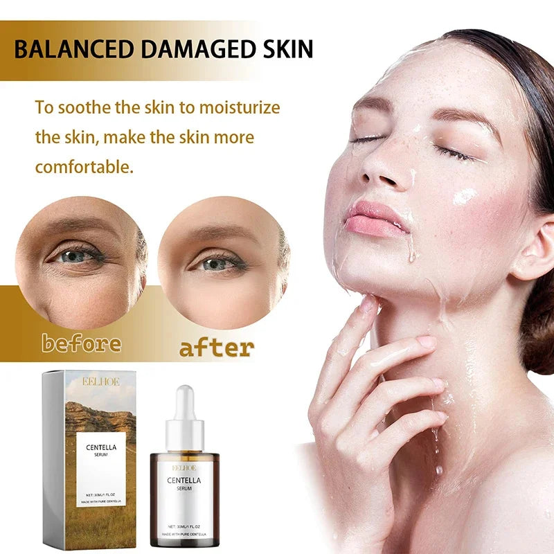 Sérum Facial con Centella Asiática Hidratante y Rejuvenecedor para Piel Seca