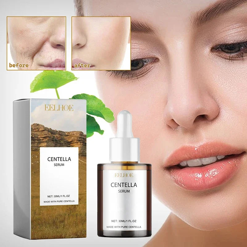 Sérum Facial con Centella Asiática Hidratante y Rejuvenecedor para Piel Seca